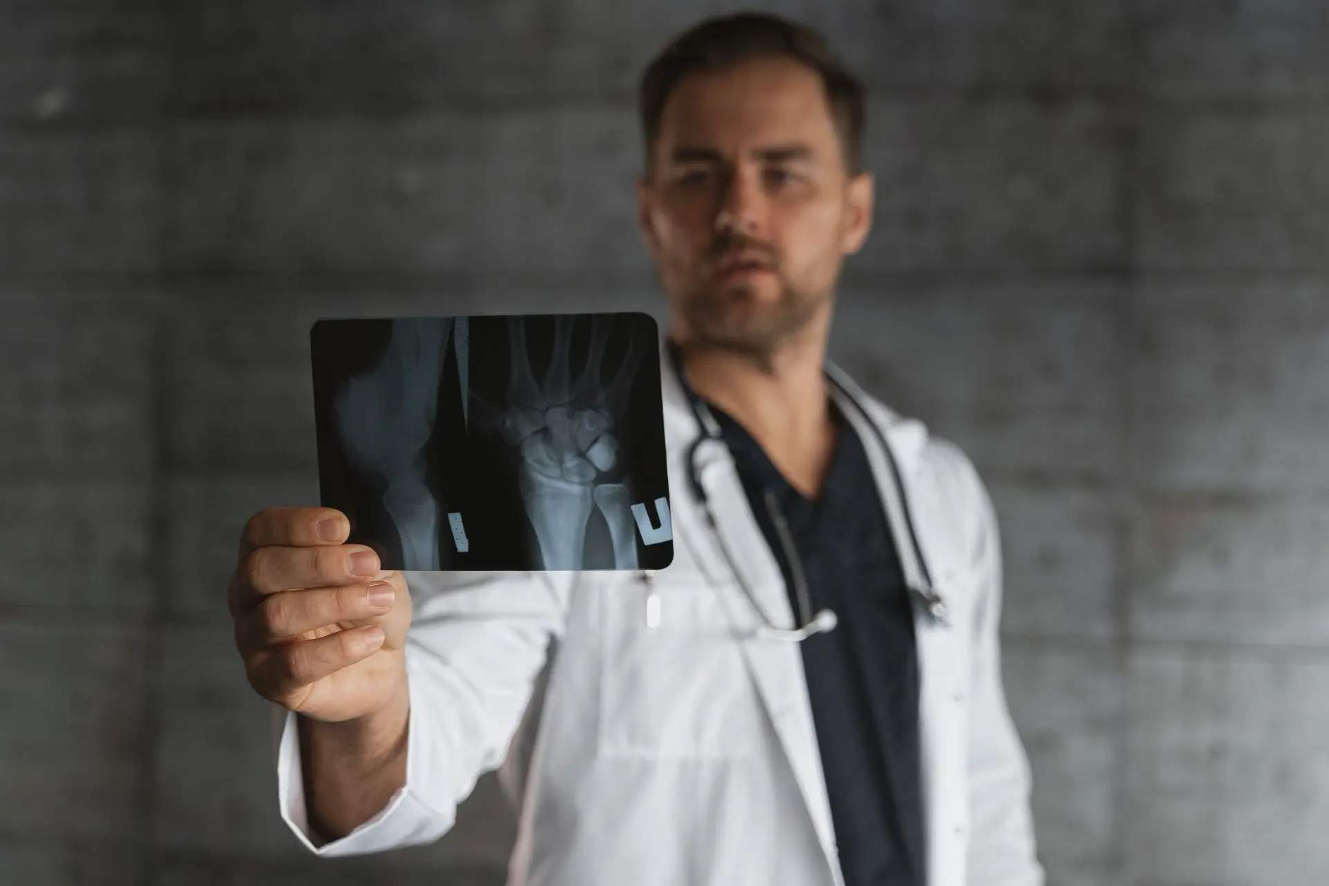 radiografia della mano per la classificazione di Eaton-Littler dell'artrosi alla base del pollice