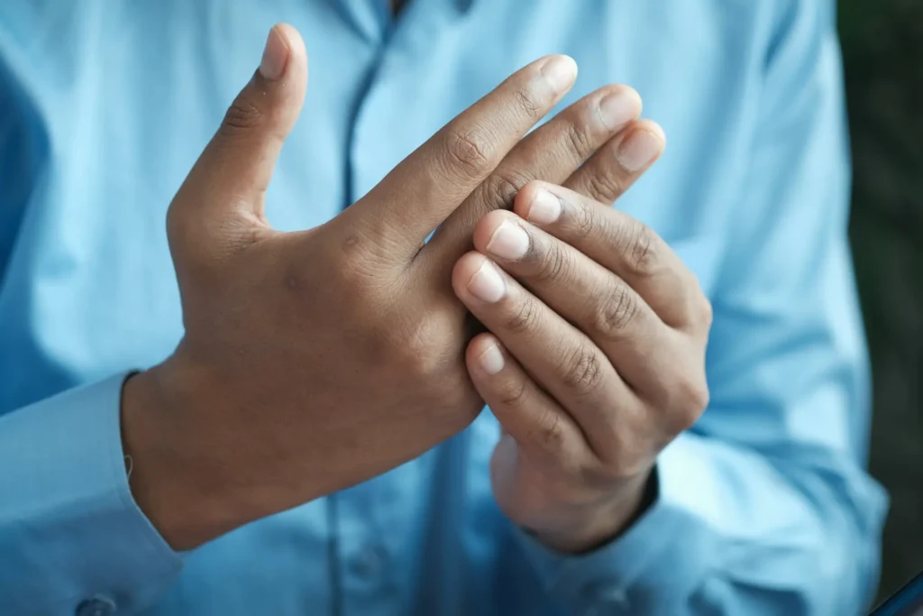 primo piano di mani con articolazioni interessate dagli osteofiti